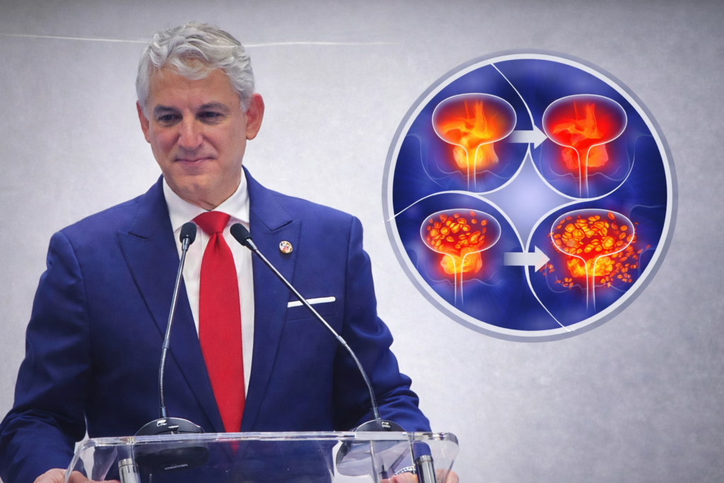 How Signs of Prostate Cancer Progress Over Time